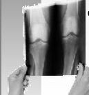 Doctors, cardiologist, rehab, physicam therapy, orthopedics,surgeon, neurologist,medical center, treatment in Lynn, MA and North Shore area and Roslindale, MA near Boston, Newton. Doctors, cardiologist, rehab, physicam therapy, orthopedics,surgeon, neurologist,medical center, treatment in Lynn, MA and North Shore area and Roslindale, MA near Boston, Newton.